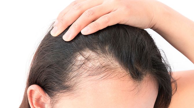 Alopecic.com is For Sale!